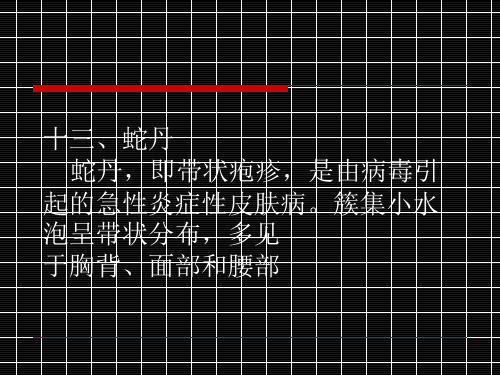蛇丹