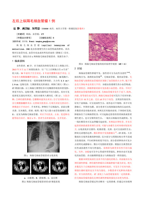 左后上纵隔毛细血管瘤1例