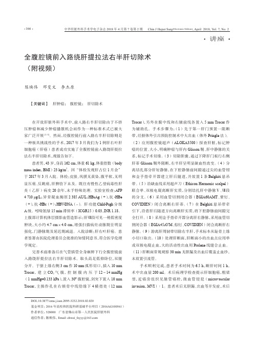 全腹腔镜前入路绕肝提拉法右半肝切除术(附视频)