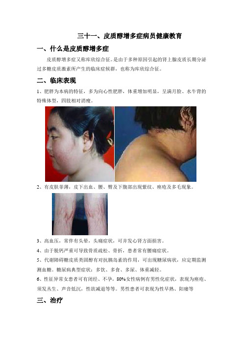 皮质醇增多症病员健康教育