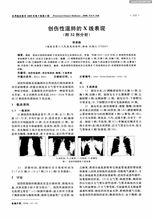创伤性湿肺的X线表现(附32例分析)