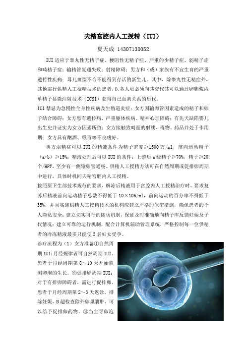 夫精宫腔内人工授精(IUI)