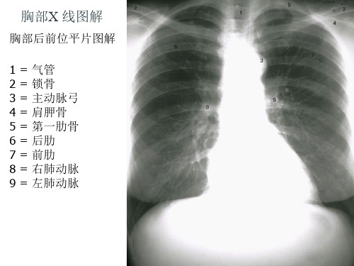 胸部X线图解