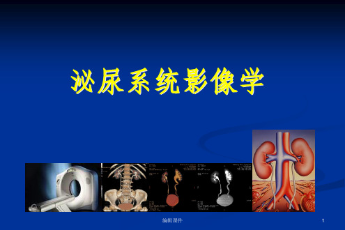 影像学——泌尿系统PPT