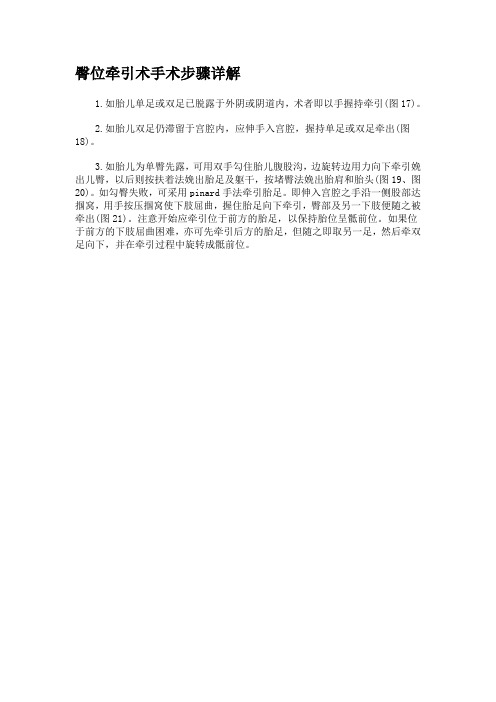 臀位牵引术手术步骤详解