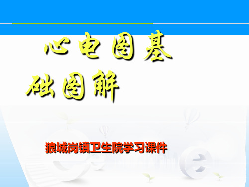 心电图基础图解