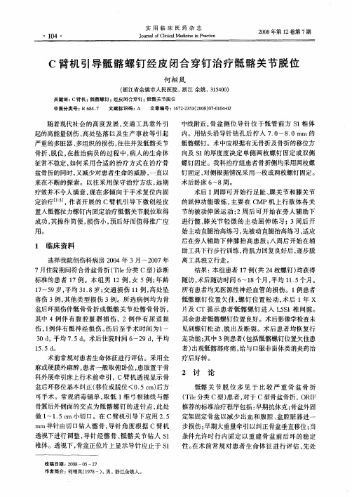 C臂机引导骶髂螺钉经皮闭合穿钉治疗骶髂关节脱位