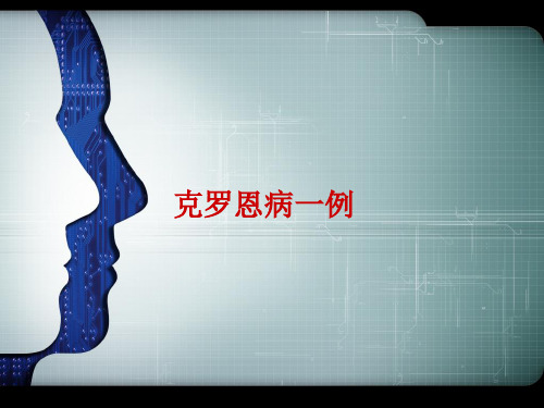 病例分析：克罗恩病患者的用药监护