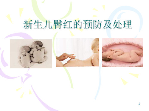新生儿臀红的预防及护理PPT医学课件