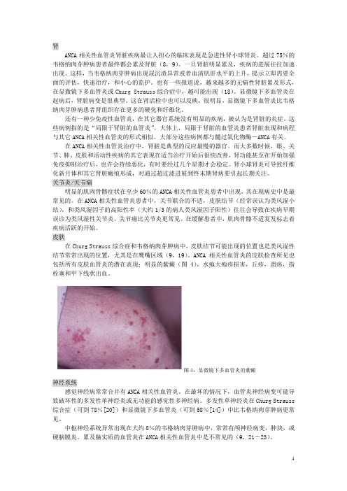 抗中性粒细胞胞浆抗体相关性血管炎(第二部分)