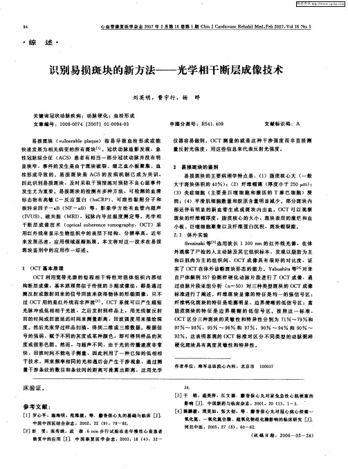 识别易损斑块的新方法——光学相干断层成像技术