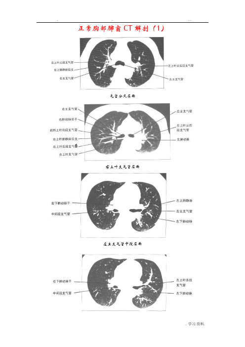 正常胸部ct解剖肺窗和纵隔窗