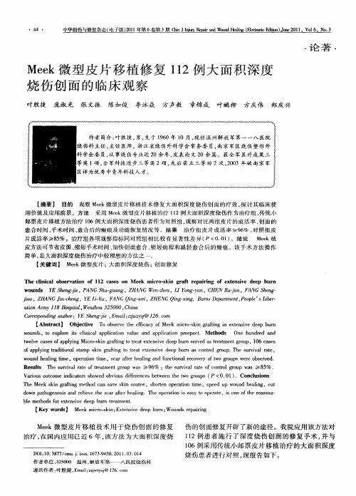 Meek微型皮片移植修复112例大面积深度烧伤创面的临床观察