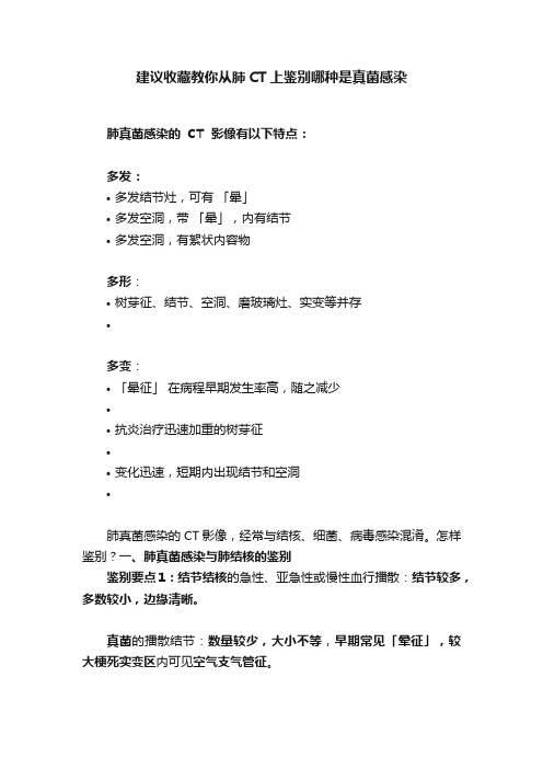 建议收藏教你从肺CT上鉴别哪种是真菌感染