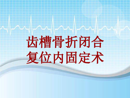 手术讲解模板：齿槽骨折闭合复位内固定术