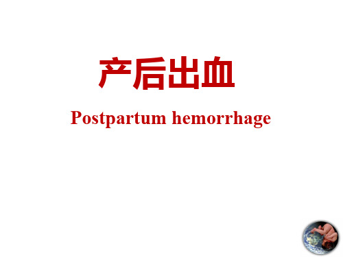 产后出血-
