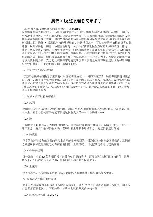 胸部X线,这么看你简单多了