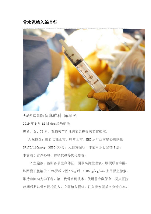 骨水泥植入综合征  大城县医院麻醉科陈军民