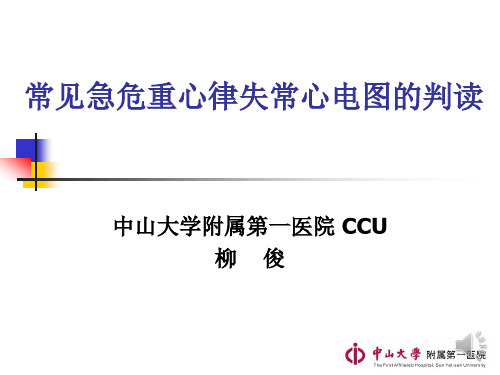 常见危重心律失常心电图判别