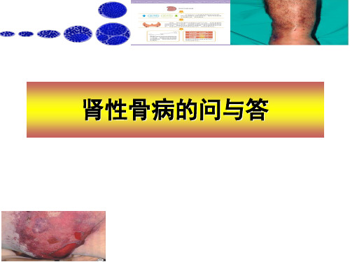 肾性骨病患者宣教-盖平