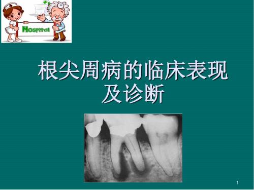 根尖周病的临床表现及诊断医学PPT课件