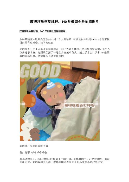 腰腹环吸恢复过程,140斤做完全身抽脂图片