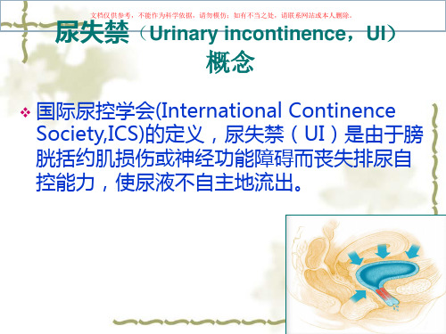 女性尿失禁和TVTadjust吊带讲座课件