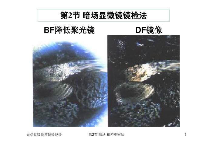 暗视野显微镜