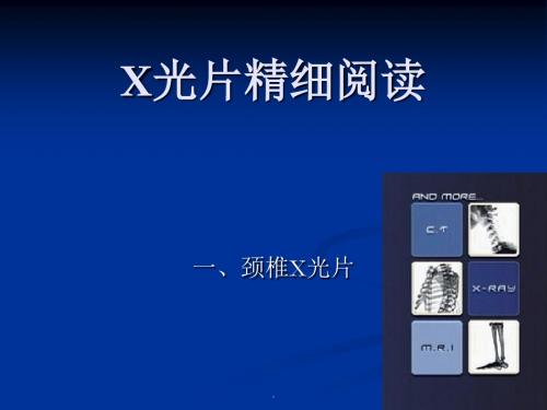 颈椎X光片阅读PPT课件