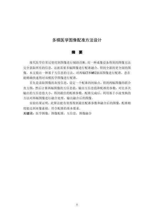 多模医学图像配准方法毕业设计
