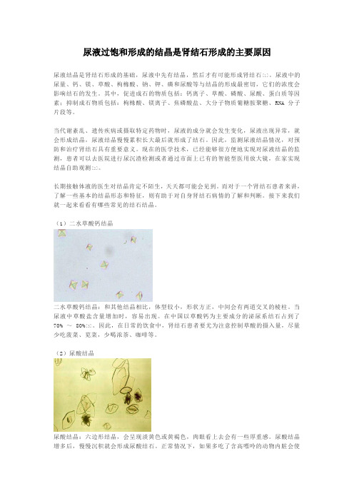 尿液过饱和形成结晶是肾结石形成的主要原因