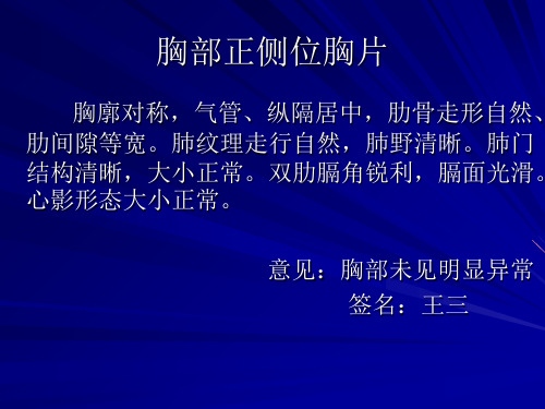 正常正侧位胸片(图19页PPT