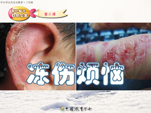 冻伤烦恼PPT课件
