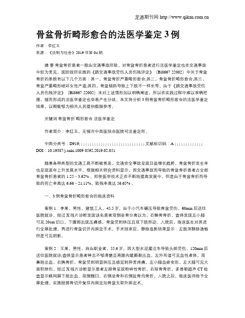 骨盆骨折畸形愈合的法医学鉴定3例
