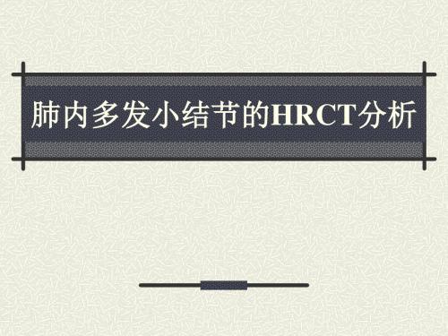 肺内小结节
