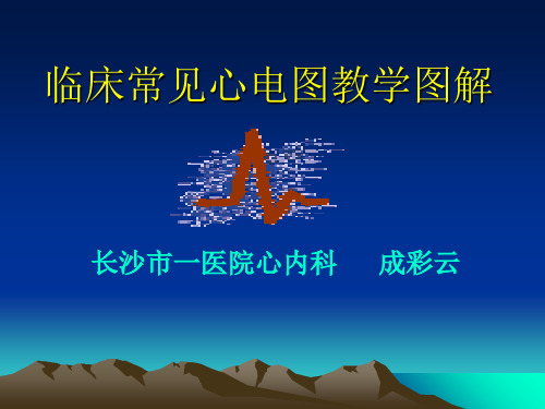 心电图基础知识ppt课件