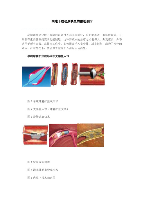 下肢动脉缺血的介入治疗
