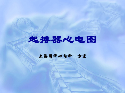 起搏器心电图-教学课件