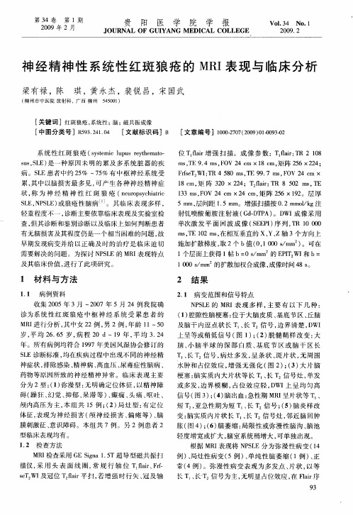 神经精神性系统性红斑狼疮的MRI表现与临床分析