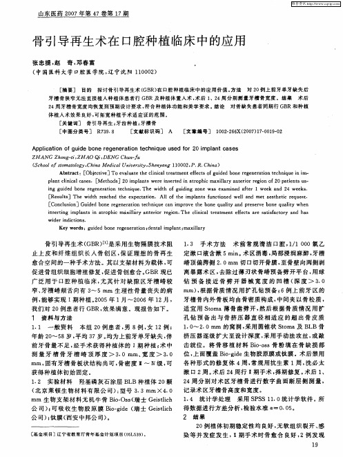 骨引导再生术在口腔种植临床中的应用
