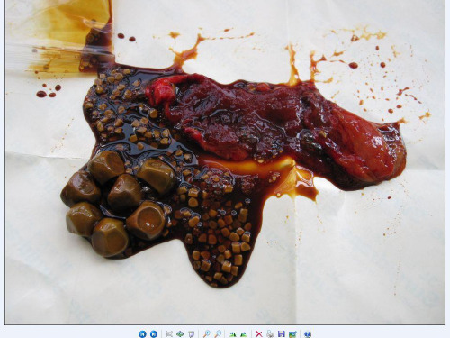 胆结石健康宣教PPT课件