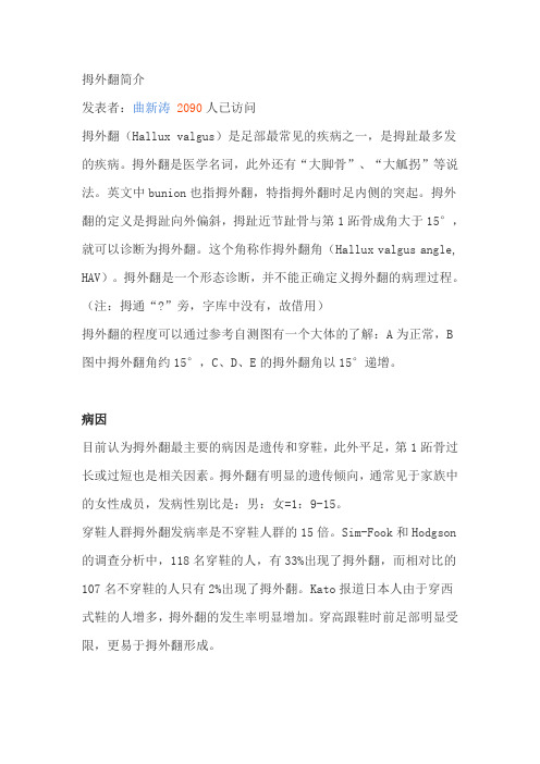拇外翻简介