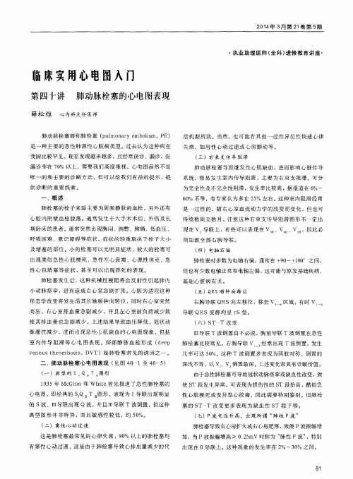 临床实用心电图入门：第四十讲肺动脉栓塞的心电图表现