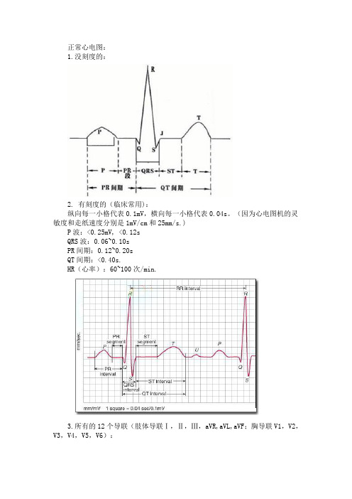 心电图速记