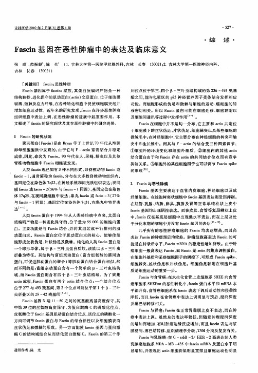 Fascin基因在恶性肿瘤中的表达及临床意义
