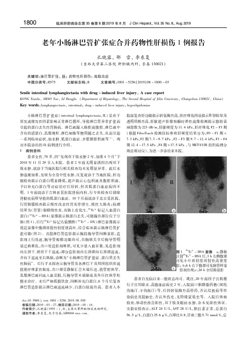 老年小肠淋巴管扩张症合并药物性肝损伤1例报告 孔晓露
