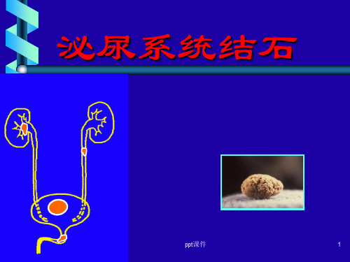 肾结石诊疗指南  ppt课件