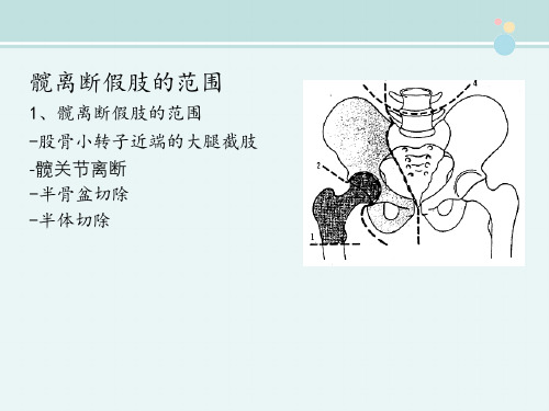 康复治疗技术 教材 髋离断假肢(接受腔特点)