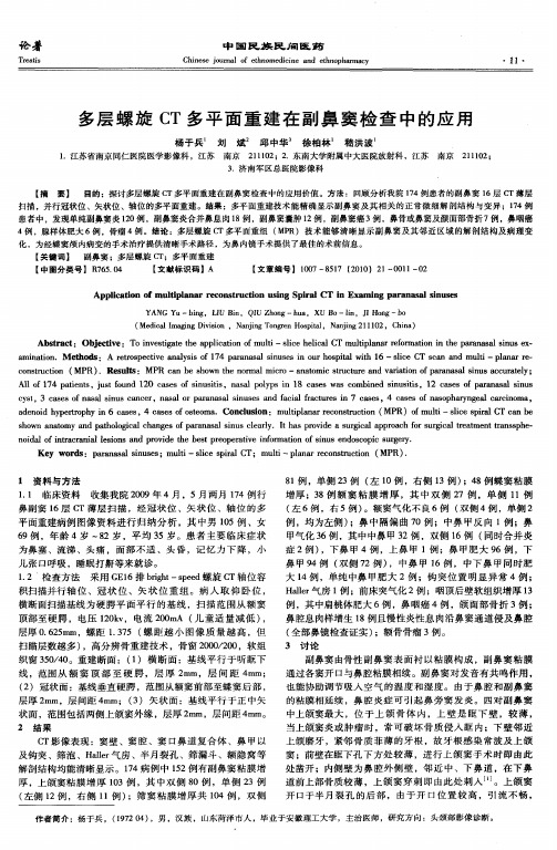 多层螺旋CT多平面重建在副鼻窦检查中的应用
