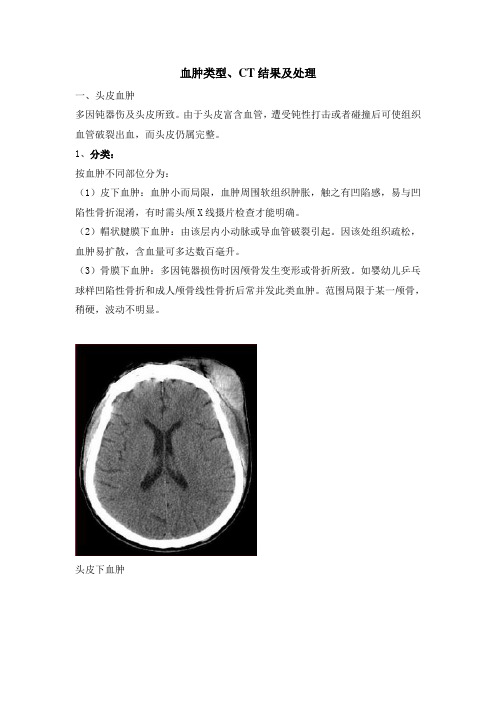 血肿类型及比较